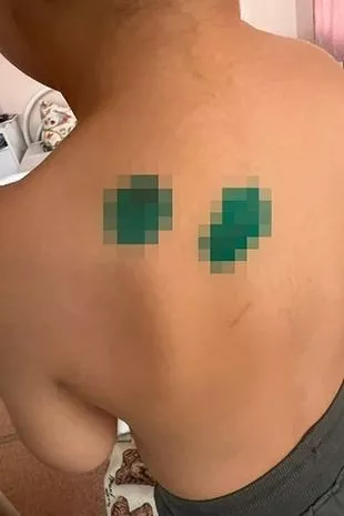 一个3岁的男孩,在马戏团里被一只狂暴的美洲豹在惊恐的观众面前咬伤